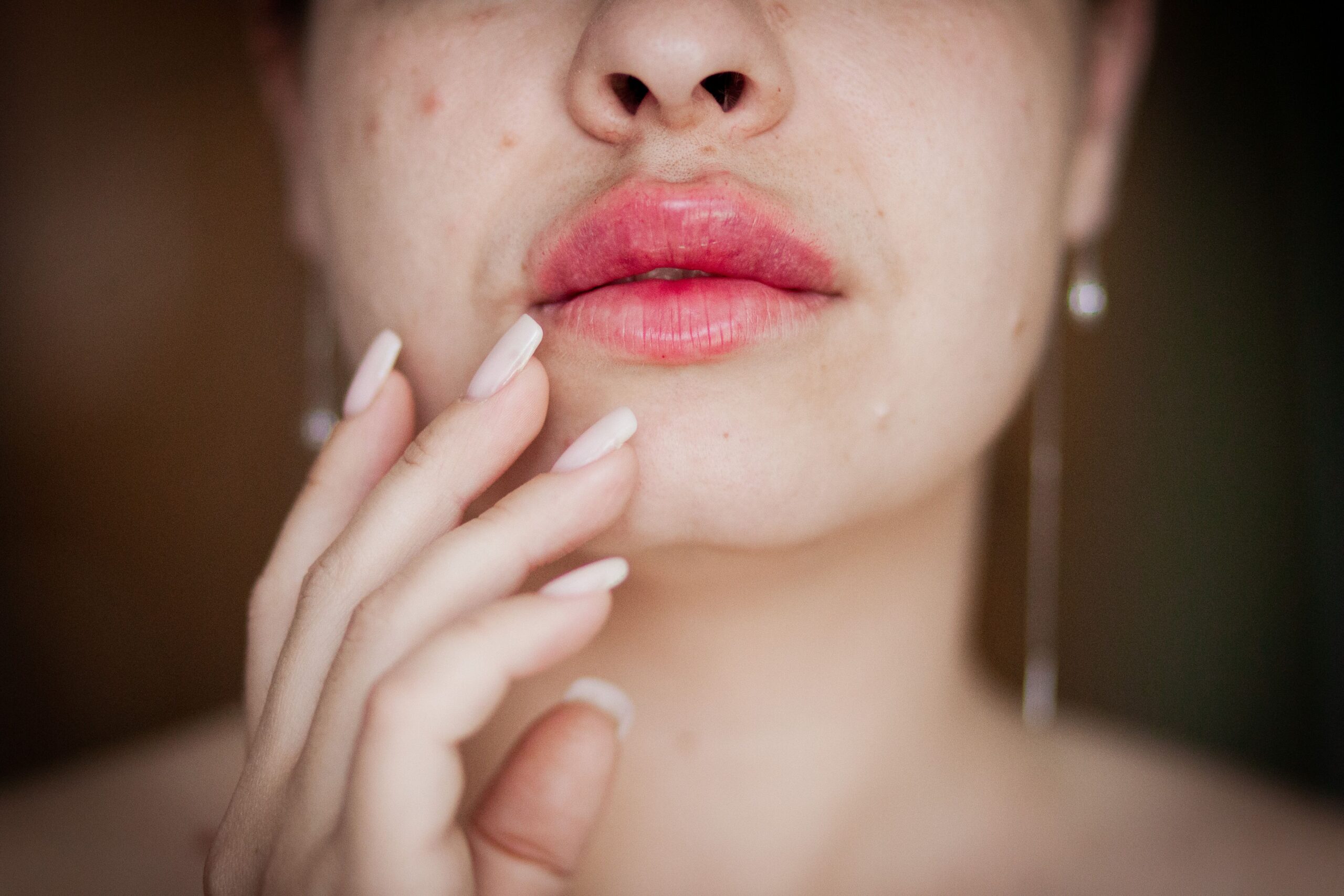 Herpes zóster: especialistas advierten mayor riesgo de infarto y ACV posterior